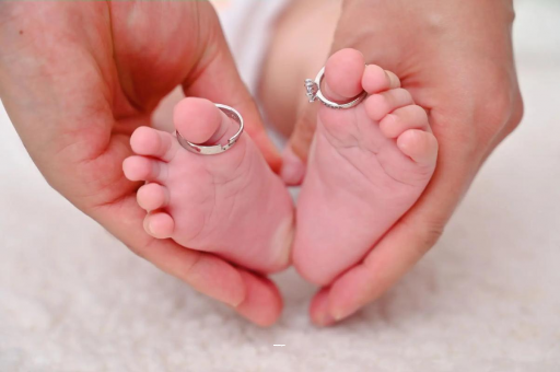 诸城胆道闭锁宝宝会放屁吗